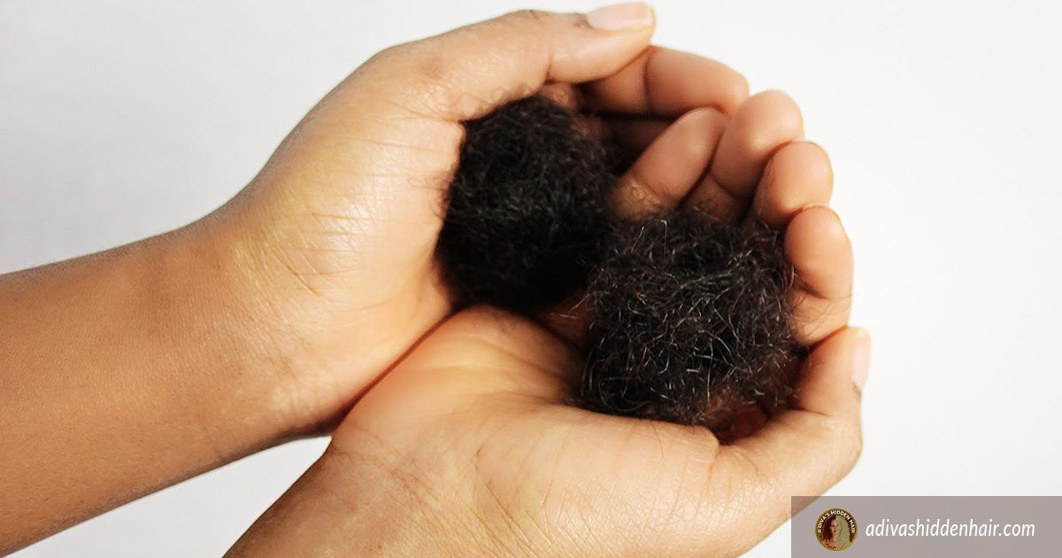 African American Women Hair Loss: Get The Facts