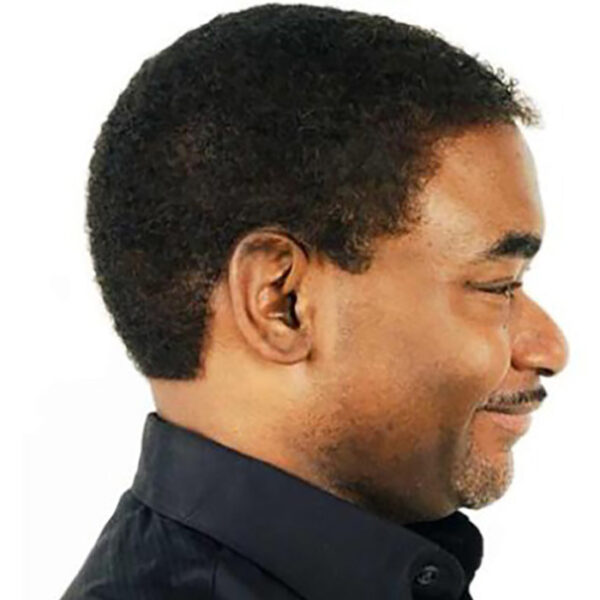 Hair Replacement System For African American Men